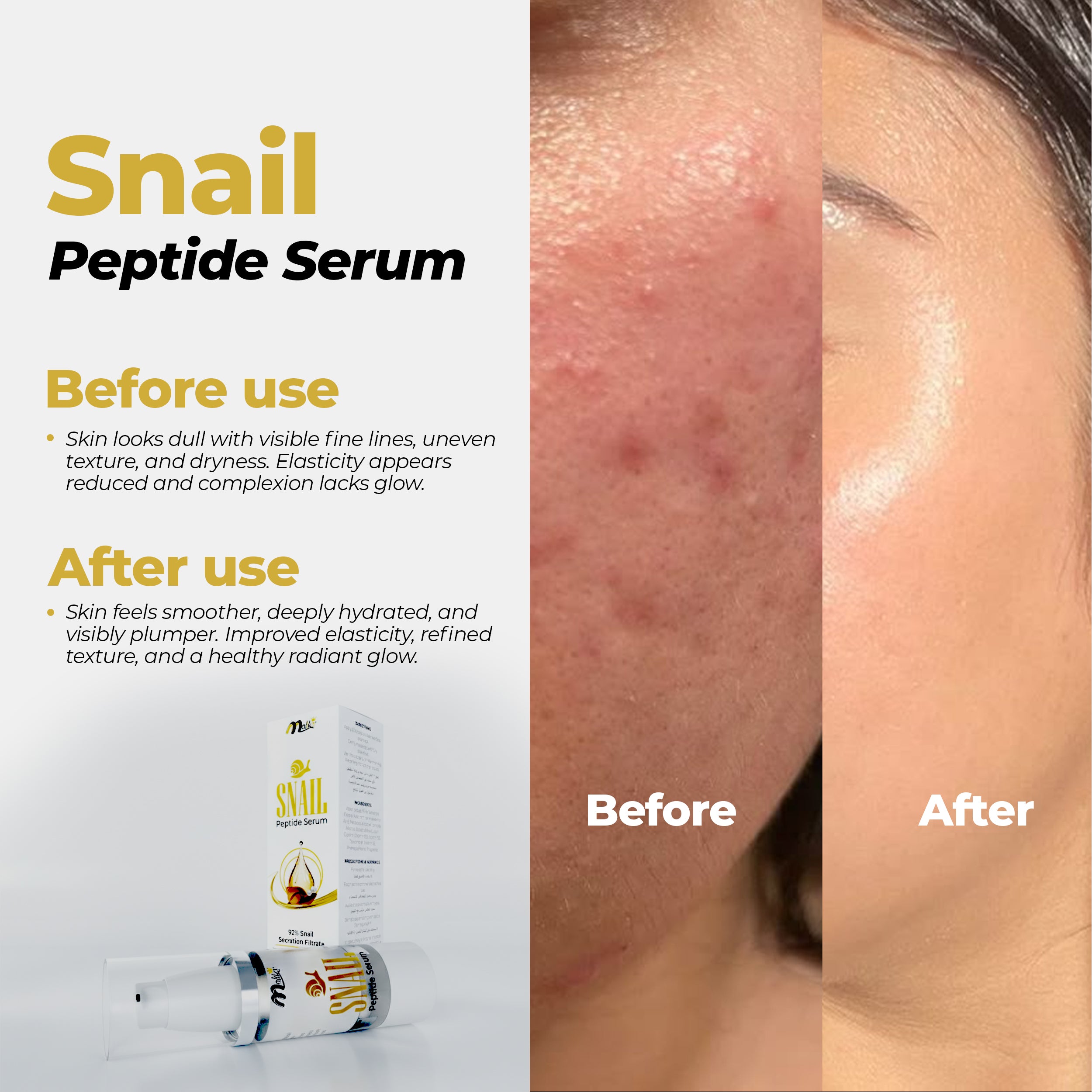 Snail Peptide Serum - 92% Snail Secretion Filtrate