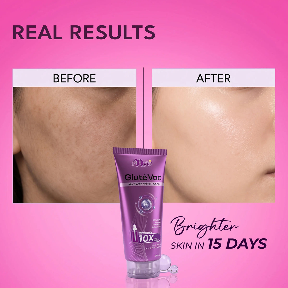 Gluté Vac