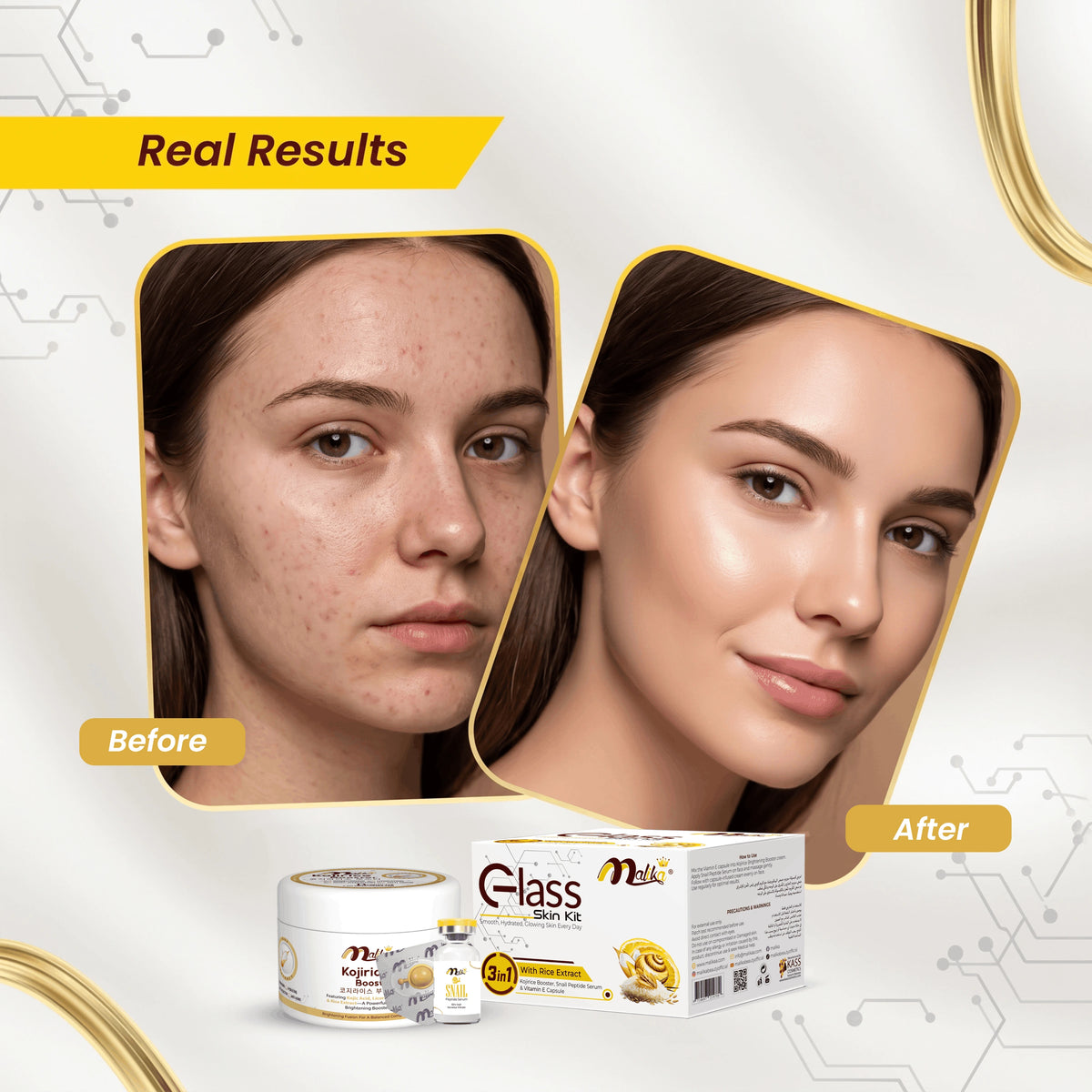 Glass Skin Kit 3 in 1 – Kojirice Cream, Serum & Capsule